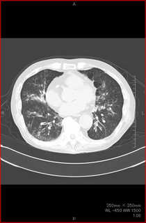 110929CT1.jpg