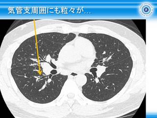 15Cǎx͂ɂXc.jpg