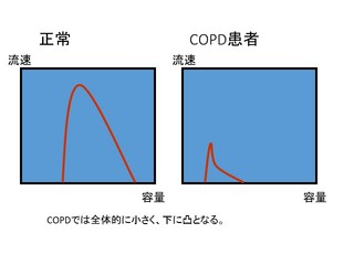 2本来のFV曲線.jpg