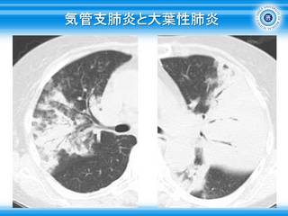 41CǎxxƑtx.jpg