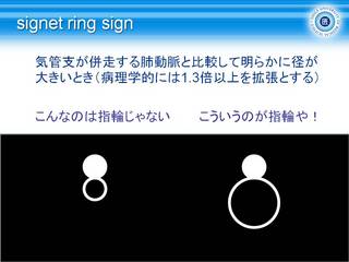 4signet ring sign.JPG