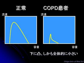 COPDスパイロ.jpg