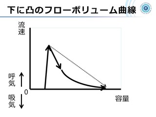 XCh1.JPG