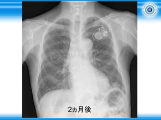 スライド115.JPG
