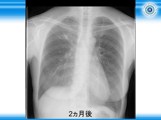スライド123.JPG