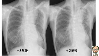 スライド152.JPG