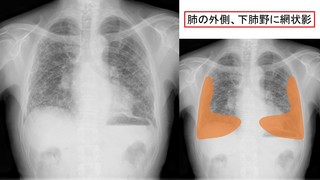 スライド3.JPG