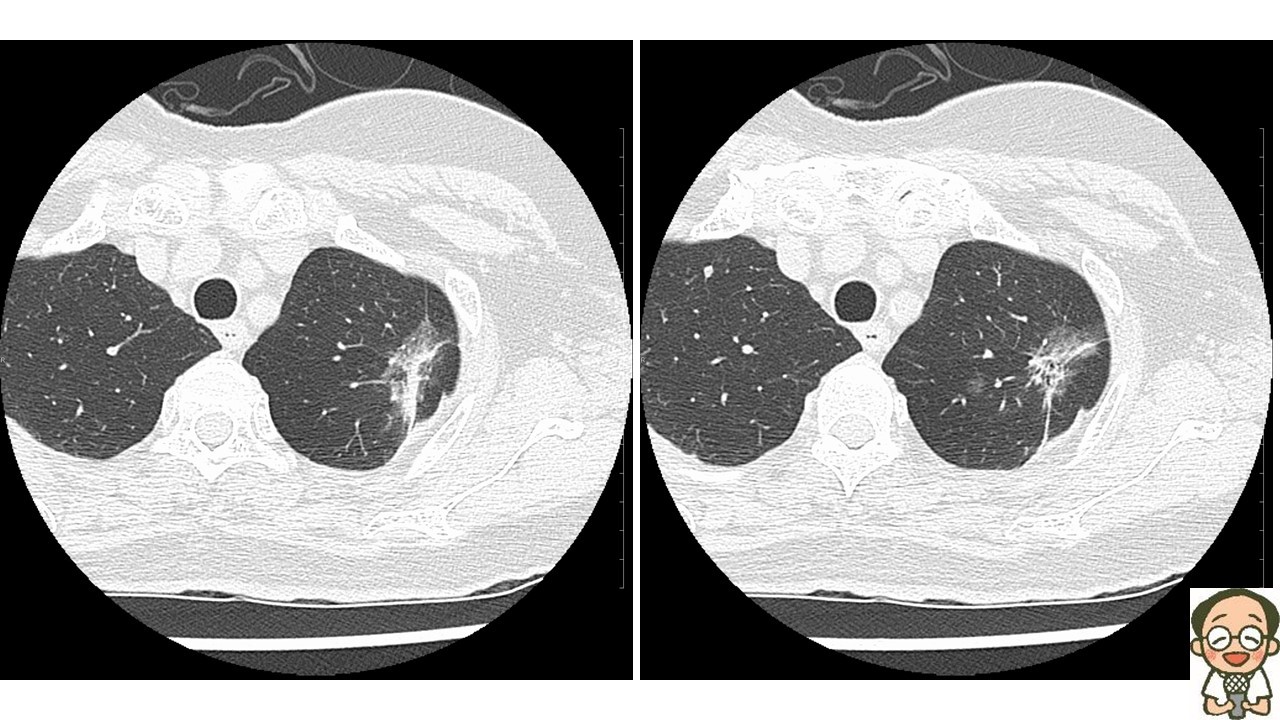 胸部X線読影道場ふたたび480: やさしイイ呼吸器教室