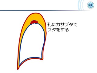 スライド51.JPG