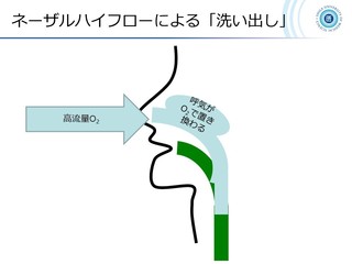 XCh56.JPG