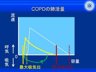 XCh58.JPG