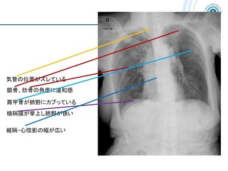 スライド6.JPG
