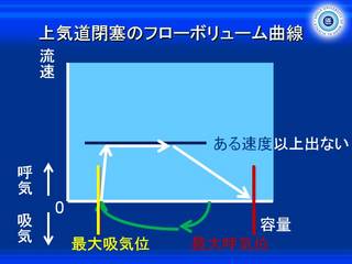 XCh67.JPG