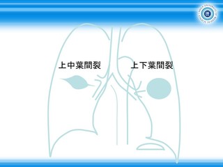 XCh71.JPG