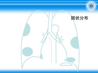 XCh84.JPG