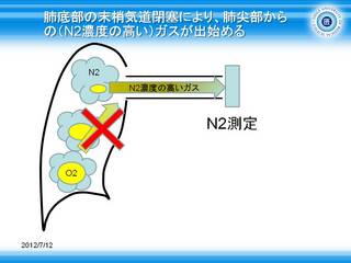 12肺底部の末梢気道閉塞により、肺尖部からの(N2濃度の高い)ガスが出始める.JPG