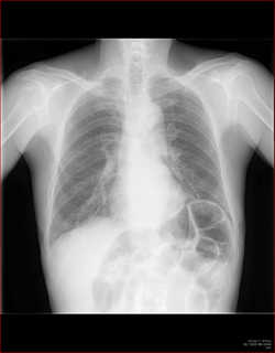 diaphragm1.jpg